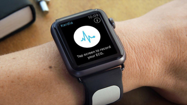 cardiograma-app-apple-watch-prevendra-infartos-3